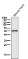 Anti-Aromatase CYP19A1 Rabbit Monoclonal Antibody